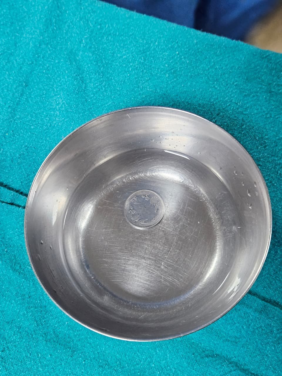 खेल रही बच्ची के गले में अटका सिक्का, मेडिकल कॉलेज अल्मोड़ा में सफल ऑपरेशन 2 IMG 20260116 WA0622 खेल रही बच्ची के गले में अटका सिक्का, मेडिकल कॉलेज अल्मोड़ा में सफल ऑपरेशन